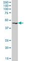 KRR1 Small Subunit Processome Component Homolog antibody, H00011103-B01P, Novus Biologicals, Western Blot image 