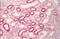 Melanocortin 1 Receptor antibody, NLS1040, Novus Biologicals, Immunohistochemistry paraffin image 