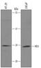 WAP Four-Disulfide Core Domain 2 antibody, PA5-47826, Invitrogen Antibodies, Western Blot image 