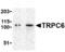 Transient Receptor Potential Cation Channel Subfamily C Member 6 antibody, ab62461, Abcam, Western Blot image 