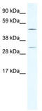 Calcium/Calmodulin Dependent Protein Kinase IV antibody, TA341837, Origene, Western Blot image 