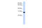 GINS Complex Subunit 2 antibody, 26-114, ProSci, Enzyme Linked Immunosorbent Assay image 