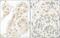 General Transcription Factor IIA Subunit 1 antibody, NBP1-46216, Novus Biologicals, Immunohistochemistry paraffin image 