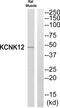 Potassium Two Pore Domain Channel Subfamily K Member 12 antibody, PA5-39343, Invitrogen Antibodies, Western Blot image 