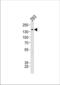 TSC Complex Subunit 2 antibody, TA324688, Origene, Western Blot image 