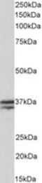 Troponin T1, Slow Skeletal Type antibody, MBS422996, MyBioSource, Western Blot image 