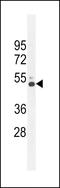 Corticotropin Releasing Hormone Receptor 2 antibody, MBS9207506, MyBioSource, Western Blot image 