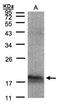 ARP antibody, NBP1-32037, Novus Biologicals, Western Blot image 