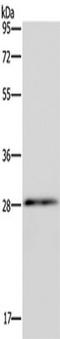 Gap Junction Protein Beta 4 antibody, TA350757, Origene, Western Blot image 