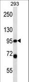 Proteasome 26S Subunit, Non-ATPase 2 antibody, LS-C162244, Lifespan Biosciences, Western Blot image 