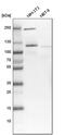 NOP2 Nucleolar Protein antibody, PA5-59073, Invitrogen Antibodies, Western Blot image 