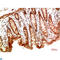 Mitogen-Activated Protein Kinase Kinase 2 antibody, LS-C813230, Lifespan Biosciences, Immunohistochemistry paraffin image 