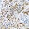 Proteasome Subunit Beta 9 antibody, GTX03219, GeneTex, Immunohistochemistry paraffin image 