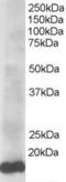 Ubiquitin Conjugating Enzyme E2 L3 antibody, EB05770, Everest Biotech, Western Blot image 