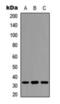 Protein Phosphatase 1 Regulatory Inhibitor Subunit 1B antibody, orb393135, Biorbyt, Western Blot image 