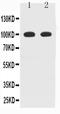 Myelin Associated Glycoprotein antibody, PA1751-1, Boster Biological Technology, Western Blot image 