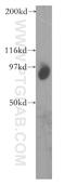 Trimethylguanosine synthase antibody, 13034-1-AP, Proteintech Group, Western Blot image 