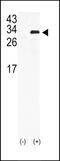 Gap Junction Protein Beta 6 antibody, 58-181, ProSci, Western Blot image 