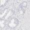 Carbonic Anhydrase 2 antibody, PA5-51598, Invitrogen Antibodies, Immunohistochemistry frozen image 