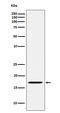 Fragile Histidine Triad Diadenosine Triphosphatase antibody, M01200-3, Boster Biological Technology, Western Blot image 