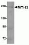 Myosin Heavy Chain 3 antibody, NBP2-81968, Novus Biologicals, Western Blot image 