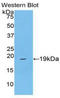 Coagulation Factor VIII antibody, LS-C293400, Lifespan Biosciences, Western Blot image 