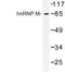 Heterogeneous Nuclear Ribonucleoprotein M antibody, LS-C177169, Lifespan Biosciences, Western Blot image 