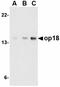 Stathmin 1 antibody, orb74843, Biorbyt, Western Blot image 