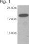 RAB3C, Member RAS Oncogene Family antibody, PA1-772, Invitrogen Antibodies, Western Blot image 