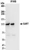 Phosphoribosylglycinamide Formyltransferase, Phosphoribosylglycinamide Synthetase, Phosphoribosylaminoimidazole Synthetase antibody, NBP2-32207, Novus Biologicals, Immunoprecipitation image 