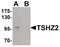 Teashirt Zinc Finger Homeobox 2 antibody, PA5-34343, Invitrogen Antibodies, Western Blot image 