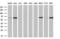 Fyn Related Src Family Tyrosine Kinase antibody, GTX84484, GeneTex, Western Blot image 