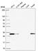 Proteasome Activator Subunit 2 antibody, HPA062661, Atlas Antibodies, Western Blot image 