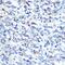 Optineurin antibody, GTX54617, GeneTex, Immunohistochemistry paraffin image 