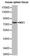 MX Dynamin Like GTPase 1 antibody, LS-C192843, Lifespan Biosciences, Western Blot image 