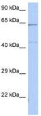 Essential Meiotic Structure-Specific Endonuclease 1 antibody, TA338859, Origene, Western Blot image 