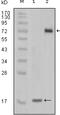 Serine/Threonine/Tyrosine Kinase 1 antibody, 32-221, ProSci, Enzyme Linked Immunosorbent Assay image 