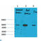 Potassium Two Pore Domain Channel Subfamily K Member 10 antibody, LS-C813634, Lifespan Biosciences, Western Blot image 