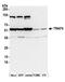 TNF Receptor Associated Factor 4 antibody, A302-840A, Bethyl Labs, Western Blot image 