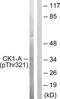 Casein Kinase 1 Alpha 1 antibody, LS-C198722, Lifespan Biosciences, Western Blot image 