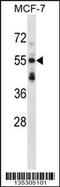Syntrophin Beta 2 antibody, 58-353, ProSci, Western Blot image 