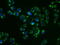 SHC Adaptor Protein 1 antibody, GTX83655, GeneTex, Immunofluorescence image 