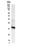 Retinol Dehydrogenase 11 antibody, PA5-73024, Invitrogen Antibodies, Western Blot image 