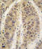 Adenosine Kinase antibody, LS-C98052, Lifespan Biosciences, Immunohistochemistry paraffin image 