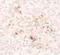 C-C Motif Chemokine Ligand 2 antibody, LS-C201039, Lifespan Biosciences, Immunohistochemistry paraffin image 