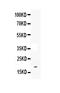 Interleukin 33 antibody, A00113, Boster Biological Technology, Western Blot image 