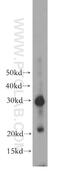 TIMP Metallopeptidase Inhibitor 3 antibody, 10858-1-AP, Proteintech Group, Western Blot image 