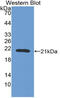 Coagulation Factor II, Thrombin antibody, abx131034, Abbexa, Western Blot image 