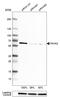 Prolyl 4-Hydroxylase Subunit Alpha 2 antibody, HPA016997, Atlas Antibodies, Western Blot image 