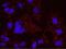 Lysine-specific demethylase 5A antibody, NB110-40499, Novus Biologicals, Proximity Ligation Assay image 